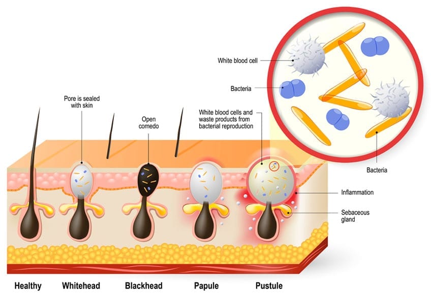 info-2