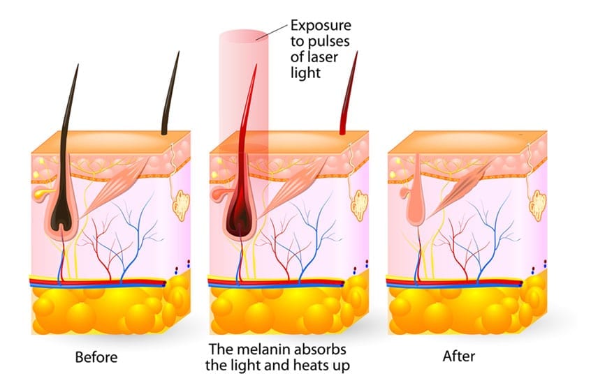 infograph