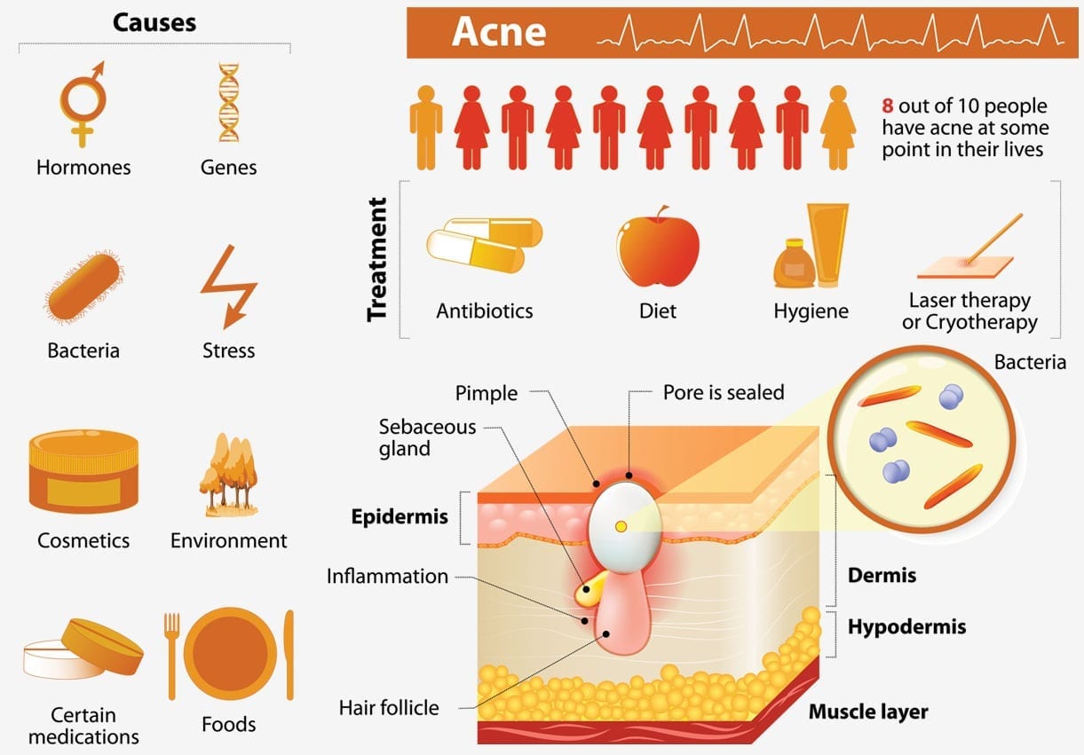 infographic