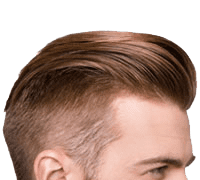 Hair-Loss_desktop