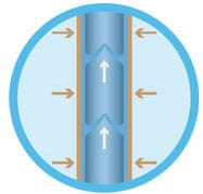 compress-vein