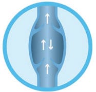 varicose-vein-info