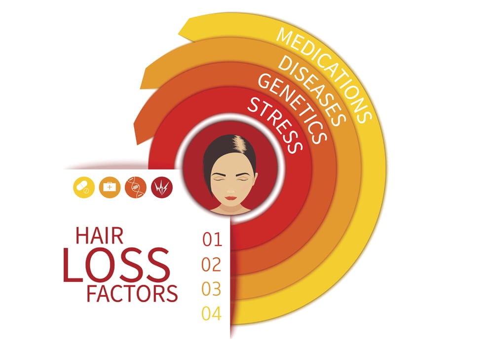 INFOGRAPHIC HAIRLOSS_woman